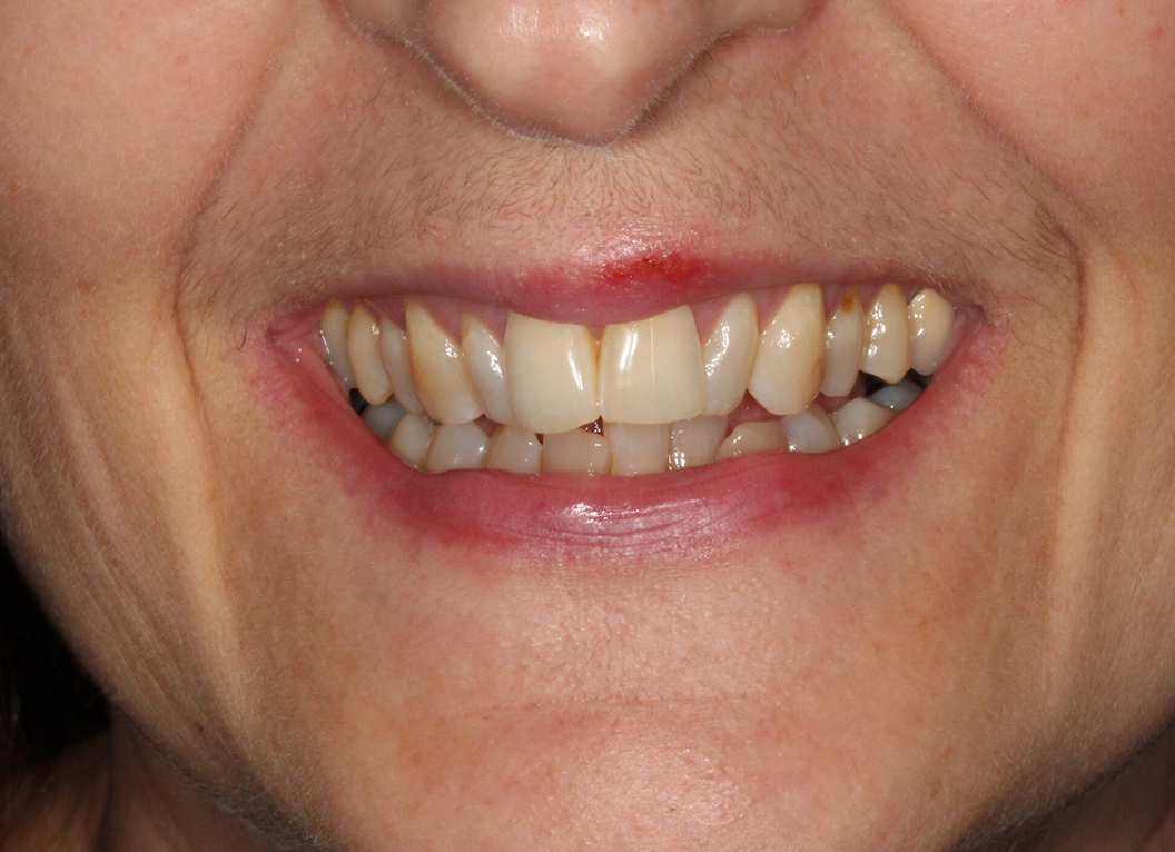 Before - The White House Dental