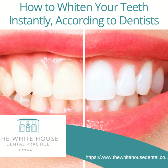 How To Whiten Your Teeth Instantly, According To Dentists