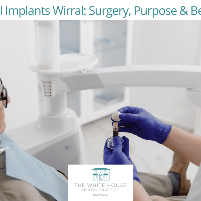 Dental Implants Wirral: Surgery, Purpose & Benefits
