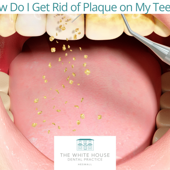How Do I Get Rid Of Plaque On My Teeth?