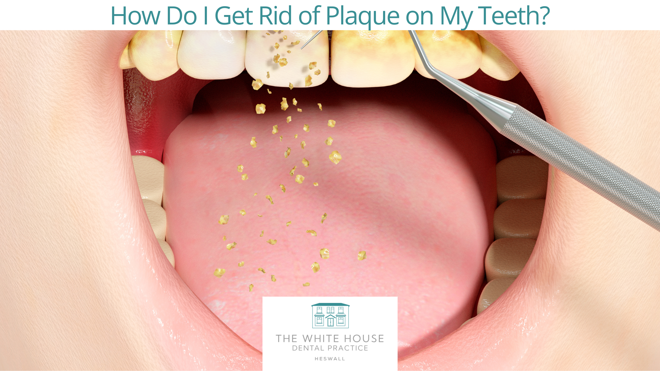 How Do I Get Rid Of Plaque On My Teeth?